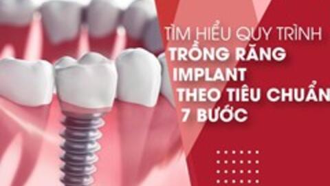 Tìm hiểu quy trình trồng răng Implant theo tiêu chuẩn 7 bước
